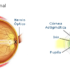 ojo astigmatico