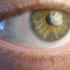 superficie ocular revision lentillas manises